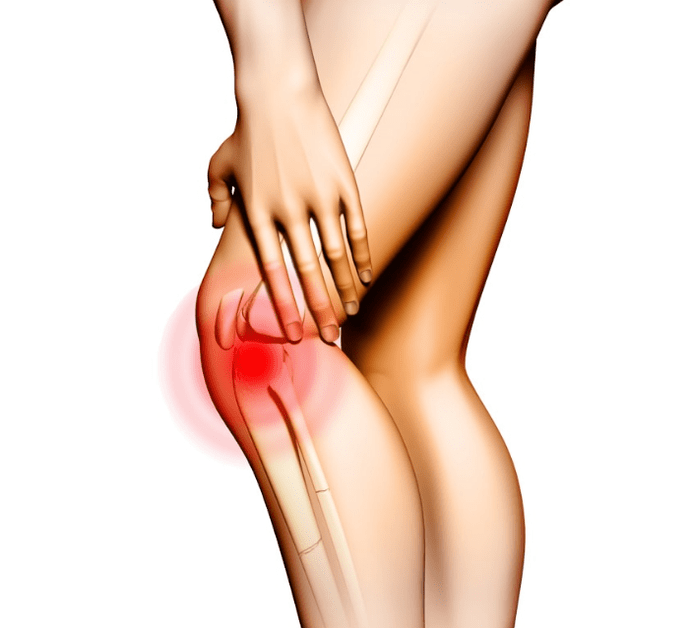 Osteoarthritis stages